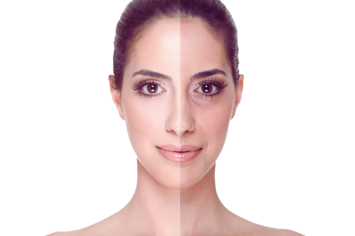 Before and After using Kangen Water-Improve Your Skin Health